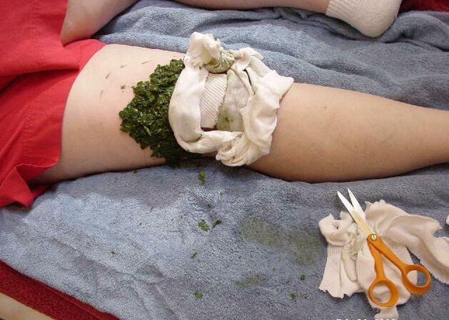 Μια ζεστή κομπρέσα από θρυμματισμένα φύλλα λάχανου σε μια πονεμένη άρθρωση του γόνατος με αρθρώσεις